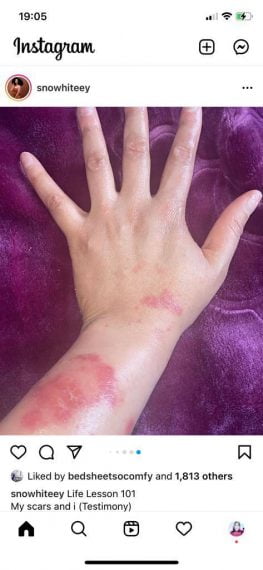 Femi Fani-Kayode’s ex-wife battles ‘rare skin disease’ (Photos)  %Post Title